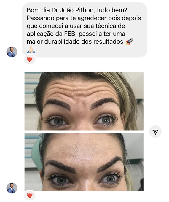 Depoimento 3 - Formação Especialista em Botox - João Pithon