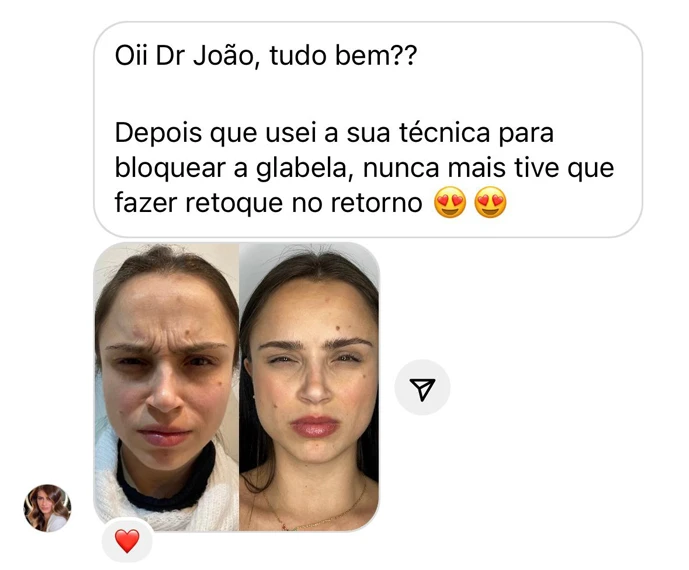 Depoimento 4 - Formação Especialista em Botox - João Pithon