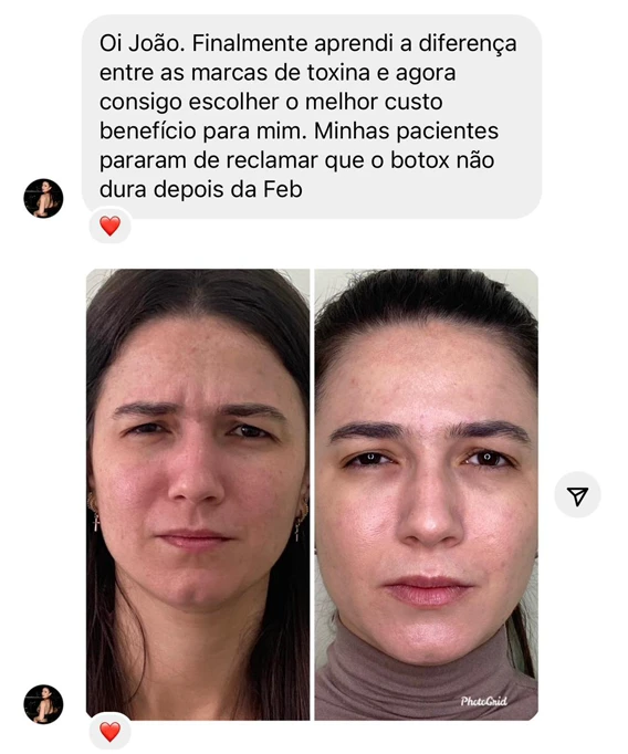 Depoimento 2 - Formação Especialista em Botox - João Pithon